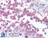 Anti-TUBG1 / Tubulin Gamma 1 Antibody (C-Terminus) IHC-plus LS-B1496