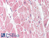 Anti-PGIS / PTGIS Antibody (aa475-490) IHC-plus LS-B1505