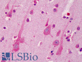 Anti-A1BG Antibody (aa123-172) IHC-plus LS-B1507