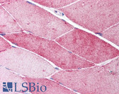 Anti-CAV3 / Caveolin 3 Antibody (N-Terminus) IHC-plus LS-B1513