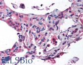 Anti-CTCF Antibody (N-Terminus) IHC-plus LS-B1518