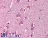 Anti-HSF1 Antibody (C-Terminus) IHC-plus LS-B1539