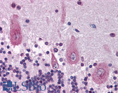 Anti-KIF21A Antibody (aa551-600) IHC-plus LS-B1542