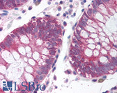 Anti-NIFK / MKI67IP Antibody (aa140-189) IHC-plus LS-B1546