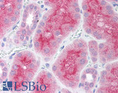 Anti-PARP2 Antibody (aa401-450) IHC-plus LS-B1553