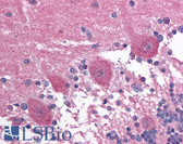 Anti-PAX3 Antibody (aa400-449) IHC-plus LS-B1554