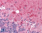 Anti-RCOR1 / COREST Antibody (C-Terminus) IHC-plus LS-B1559