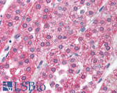 Anti-Recoverin Antibody (aa131-180) IHC-plus LS-B1560