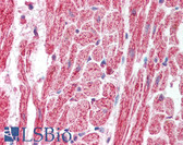 Anti-SAP18 Antibody (aa30-79) IHC-plus LS-B1561