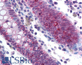 Anti-SF1 Antibody (aa517-566) IHC-plus LS-B1563