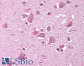 Anti-SIRT2 / Sirtuin 2 Antibody (N-Terminus) IHC-plus LS-B1565