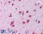 Anti-SOX12 Antibody (C-Terminus) IHC-plus LS-B1568