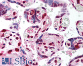Anti-TCF4 Antibody (aa73-122) IHC-plus LS-B1570