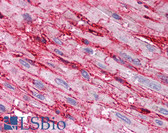 Anti-CD36 Antibody (aa99-114) IHC-plus LS-B1590