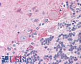 Anti-CNR1 / CB1 Antibody (aa461-472) IHC-plus LS-B1591