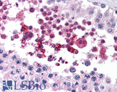 Anti-GPX4 / MCSP Antibody (aa81-93) IHC-plus LS-B1596