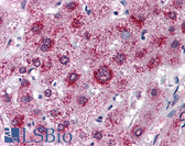 Anti-LDLR / LDL Receptor Antibody (aa499-511) IHC-plus LS-B1598