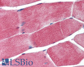 Anti-PPARG / PPAR Gamma Antibody (aa82-101) IHC-plus LS-B1606