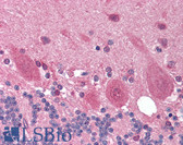 Anti-OPTN / Optineurin Antibody (aa575-591) IHC-plus LS-B1611