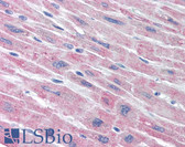 Anti-PLA2G5 Antibody (clone MCL-3G1) IHC-plus LS-B1613
