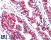 Anti-SLC45A3 / Prostein Antibody IHC-plus LS-B1623