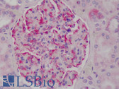 Anti-NFKBIA / IKB Alpha / IKBA Antibody (C-Terminus) IHC-plus LS-B1640