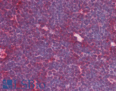 Anti-MRE11A / MRE11 Antibody (aa182-582, clone 12D7) IHC-plus LS-B1700