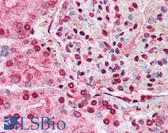 Anti-NBN / Nibrin Antibody (clone 1D7) IHC-plus LS-B1701