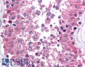 Anti-RAD1 Antibody (N-Terminus, clone 4126) IHC-plus LS-B1706