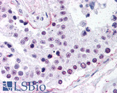 Anti-RAD50 Antibody (aa1-425, clone 13B3) IHC-plus LS-B1708