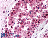 Anti-RBBP4 / RBAP48 Antibody (aa1-425, clone 11G10) IHC-plus LS-B1710