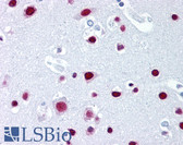 Anti-SAFB1 / SAFB Antibody (aa345-357, clone 6F7) IHC-plus LS-B1712