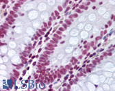 Anti-p84 / THOC1 Antibody (aa15-374, clone 5E10) IHC-plus LS-B1713
