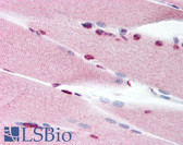Anti-TP53BP1 / 53BP1 Antibody (C-Terminus) IHC-plus LS-B1714