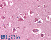 Anti-XRCC5 / Ku80 Antibody (C-Terminus, clone 149.8) IHC-plus LS-B1718
