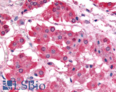 Anti-PDK1 Antibody (aa350-436) IHC-plus LS-B1733