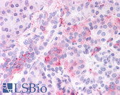 Anti-KCNMB3 Antibody (Internal) IHC-plus LS-A8110