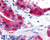 Anti-TRPM8 Antibody (Internal) IHC-plus LS-A8090