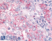 Anti-USP4 Antibody (N-Terminus) IHC-plus LS-A8558