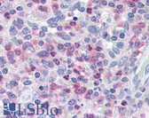 Anti-UNC13D Antibody (C-Terminus) IHC-plus LS-B1748