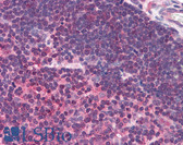 Anti-UNC13D Antibody (Internal) IHC-plus LS-B1749
