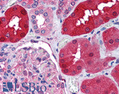 Anti-RNF213 Antibody (Internal) IHC-plus LS-B1757