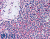 Anti-UBASH3A / CLIP4 Antibody (Internal) IHC-plus LS-B1765