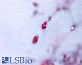 Anti-Aggrecan Antibody (N-Terminus) IHC-plus LS-A1556