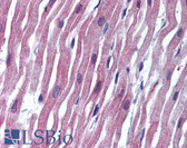 Anti-SCN5A / Nav1.5 Antibody (Internal) IHC-plus LS-A9602