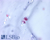 Anti-Aggrecan Antibody (C-Terminus) IHC-plus LS-A1562