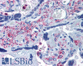 Anti-ADAMTS5 Antibody (Internal) IHC-plus LS-A1535