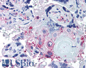 Anti-ADAMTS5 Antibody (Internal) IHC-plus LS-A1536