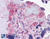 Anti-ADAMTS5 Antibody (Internal) IHC-plus LS-A1540
