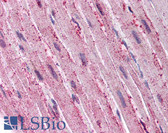 Anti-ADAMTS4 Antibody (C-Terminus) IHC-plus LS-A1551